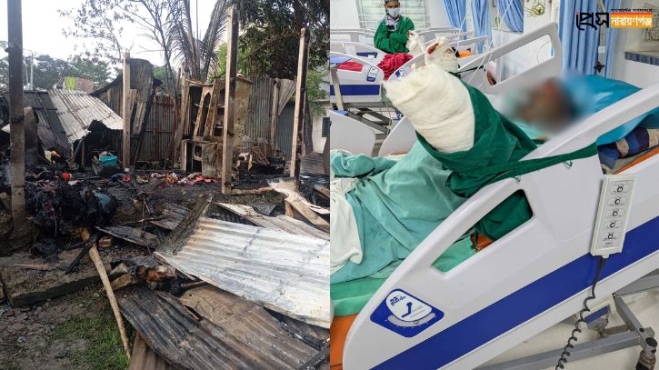 রূপগঞ্জে বিধবার বসতবাড়িতে আগুন: দগ্ধ ছেলের মৃত্যু