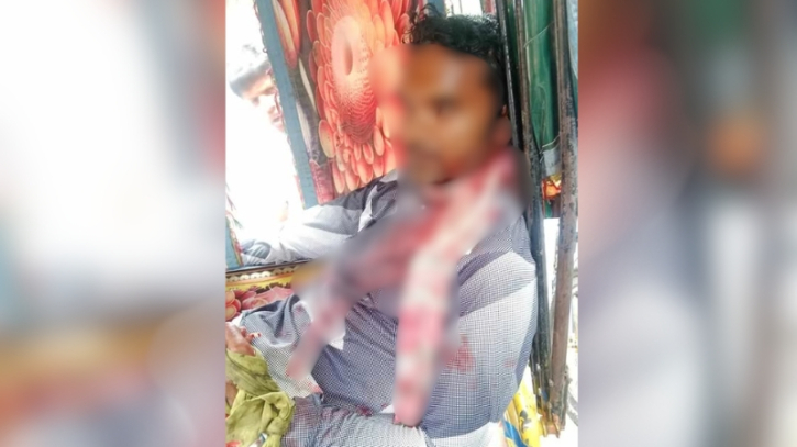 ফতুল্লায় যাত্রীবেশে অটোরিকশা চালকের গলা কেটে হত্যার চেষ্টা, রগ কাটা অবস্থায় ঢামেকে ভর্তি