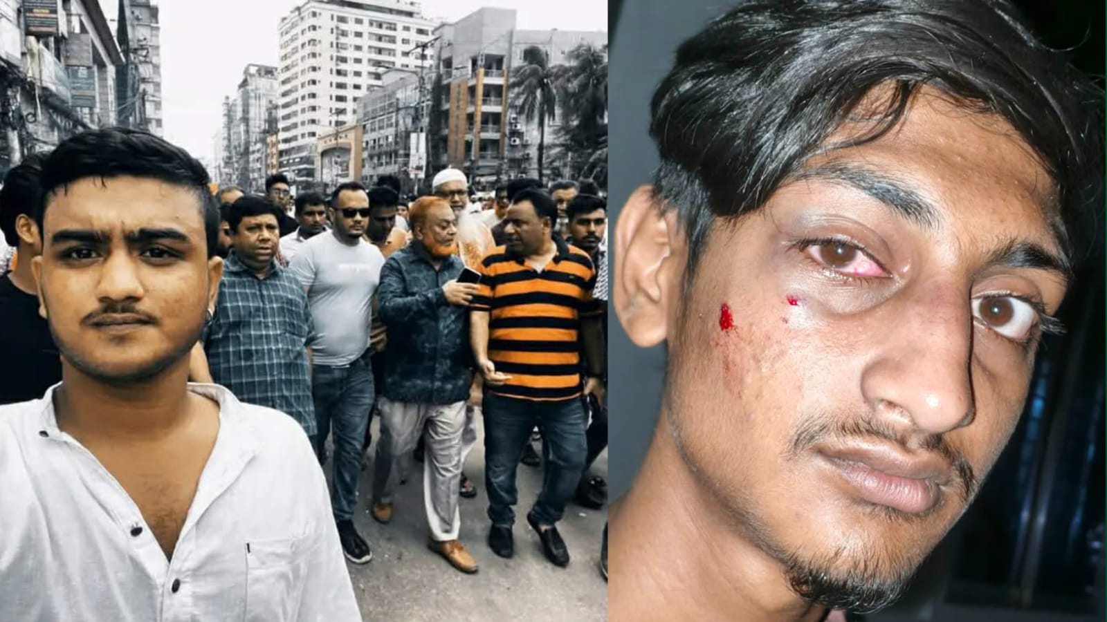 সিদ্ধিরগঞ্জে যুবককে কুপিয়ে জখম ও ছিনতাইয়ের অভিযোগ  নারায়ণগঞ্জের সিদ্ধিরগঞ্জ থানাধীন